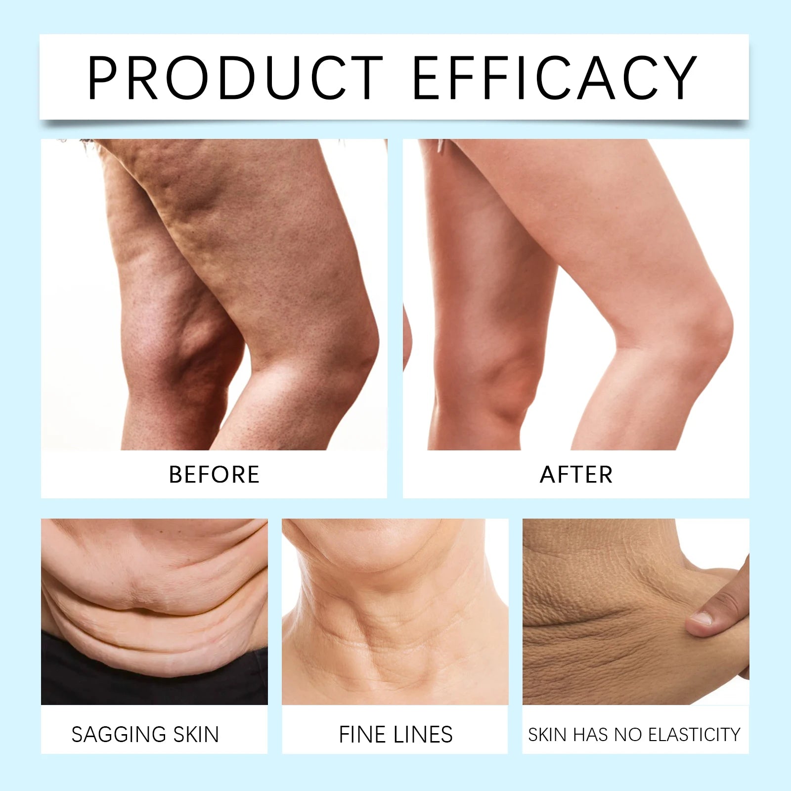 Anti Cellulite Cream